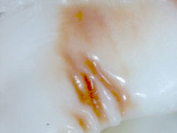 Nerita signata - Neritidae